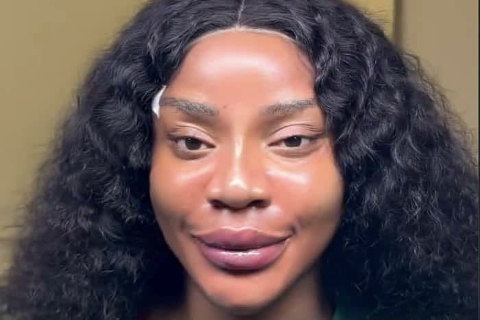 Uche Ogbodo Expresses Disappointment Over Appearance After Cosmetic Procedure